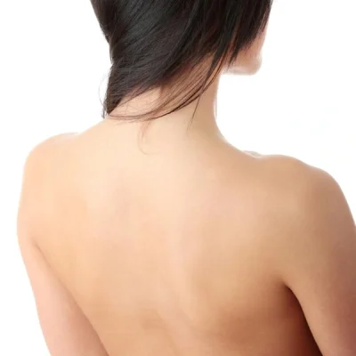 Depilação a Laser Costas Feminino