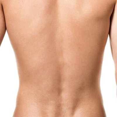 Depilação a Laser Lombar Masculino